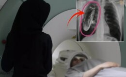 Hastaya "Göğsünde canlı böcek var" dendi, gerçek çok başka çıktı