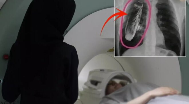 Hastaya "Göğsünde canlı böcek var" dendi, gerçek çok başka çıktı