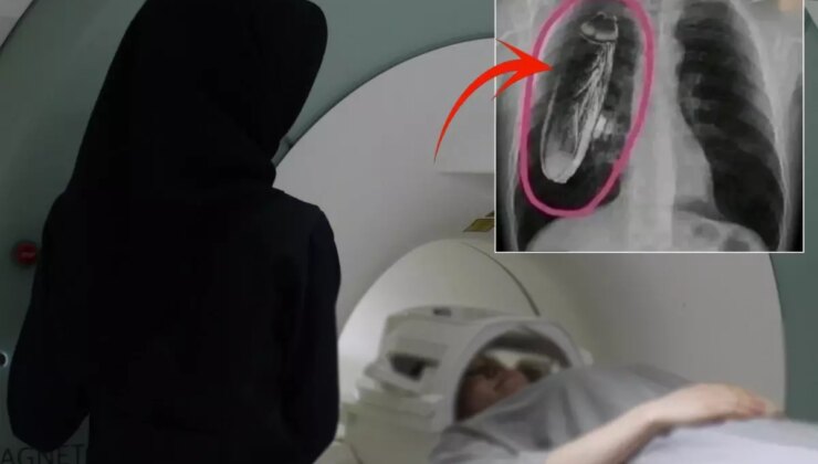 Hastaya "Göğsünde canlı böcek var" dendi, gerçek çok başka çıktı