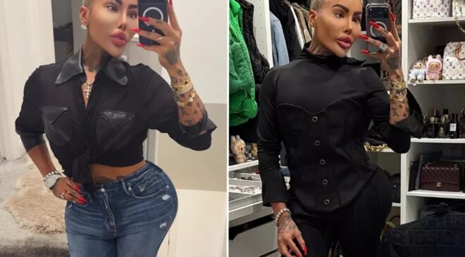 Kim Kardashian’a benzemek için estetik yaptıran fenomen hayatını kaybetti: 2 kişi cinayetten tutuklandı