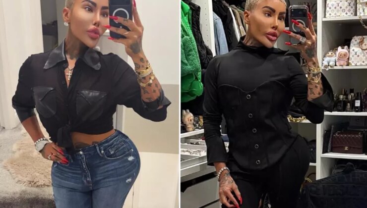 Kim Kardashian’a benzemek için estetik yaptıran fenomen hayatını kaybetti: 2 kişi cinayetten tutuklandı