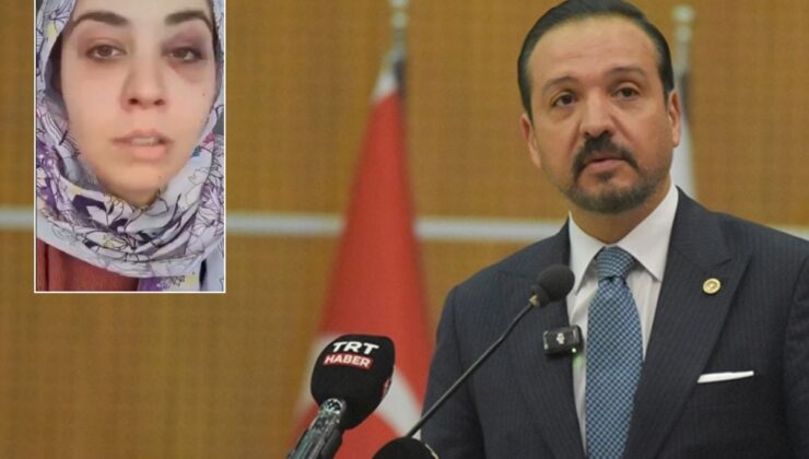 Gelin gittiği Afganistan’da kabusu yaşadı! Türkiye hemen devreye girdi